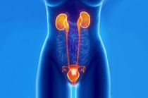 C&acirc;ncer da bexiga: o que &eacute;? Quais as causas? O que sente uma pessoa com este tumor? Qual a evolu&ccedil;&atilde;o?