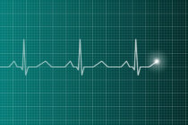Cardiomiopatia hipertr&oacute;fica: entenda esta condi&ccedil;&atilde;o