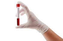 Coagula&ccedil;&atilde;o intravascular disseminada: como ela &eacute;?