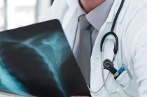 Como &eacute; a fibrose c&iacute;stica?
