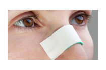 Desvio de septo nasal: causas, manifesta&ccedil;&otilde;es, como corrigir, quais as poss&iacute;veis complica&ccedil;&otilde;es da cirurgia de corre&ccedil;&atilde;o