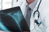 Febre dos papagaios: diagn&oacute;stico e tratamento da psitacose em humanos