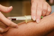 Hemocultura - o que &eacute; importante saber sobre ela?