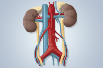Hidronefrose: defini&ccedil;&atilde;o, causas, sinais e sintomas, diagn&oacute;stico, tratamento, evolu&ccedil;&atilde;o, preven&ccedil;&atilde;o e complica&ccedil;&otilde;es