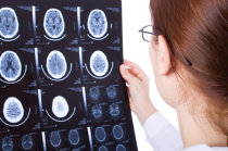 Morte cerebral ou morte encef&aacute;lica: o que &eacute;?