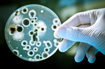 O que s&atilde;o bact&eacute;rias? Onde elas vivem? O que elas podem causar aos seres humanos? Elas podem ser &uacute;teis? O que &eacute; um antibiograma?