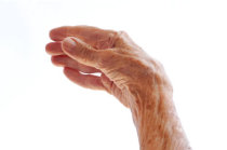 Por que meus dedos estão ficando tortos e doloridos? Pode ser artrose? Conheça esta condição e ajude a preveni-la Por que meus dedos estão ficando tortos e doloridos? Pode ser artrose? Conheça esta condição e ajude a preveni-la
