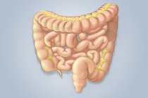S&iacute;ndrome do intestino curto