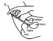 Clotrimazol (Creme vaginal 10 mg/g)